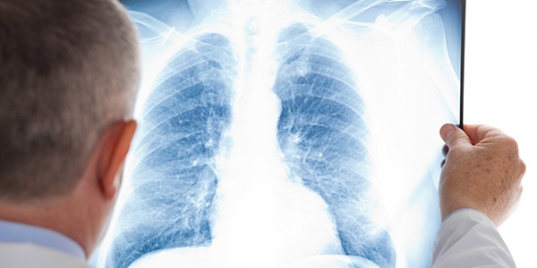 Заболевания дыхательной системы